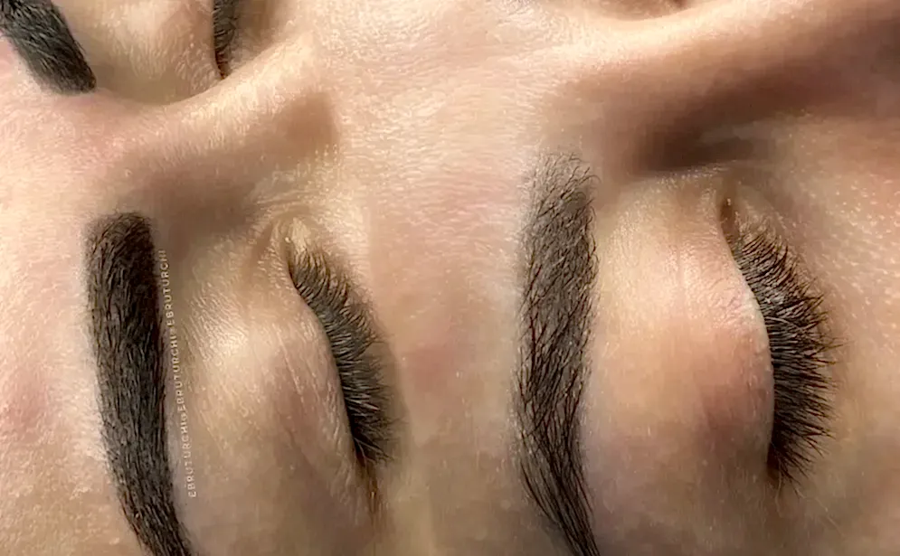 28